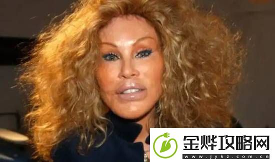 整容成“猫女”的瑞士名媛因心脏衰竭去世享年84岁